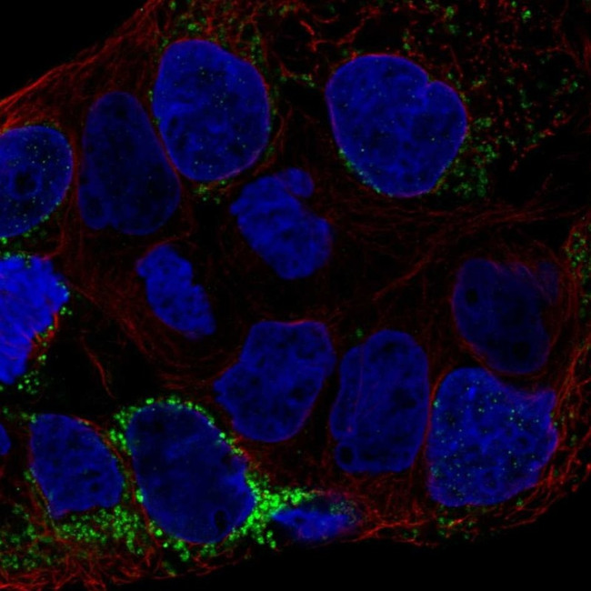 CLN6 Antibody in Immunocytochemistry (ICC/IF)