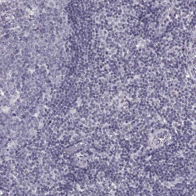 LRRC50 Antibody in Immunohistochemistry (Paraffin) (IHC (P))