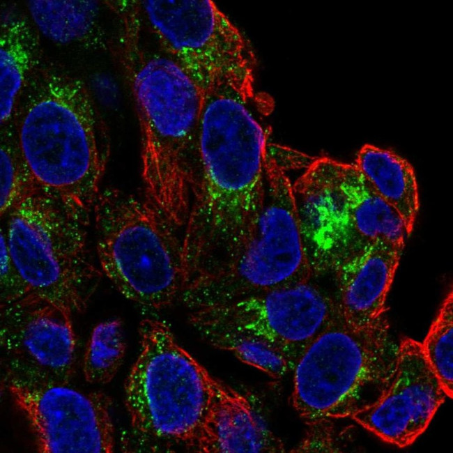 SLC6A4 Antibody in Immunocytochemistry (ICC/IF)