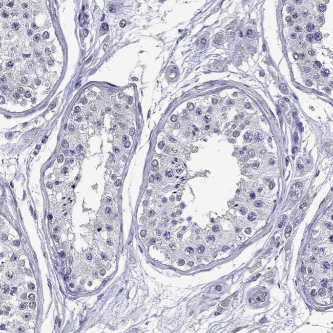 Aquaporin 9 Antibody in Immunohistochemistry (Paraffin) (IHC (P))