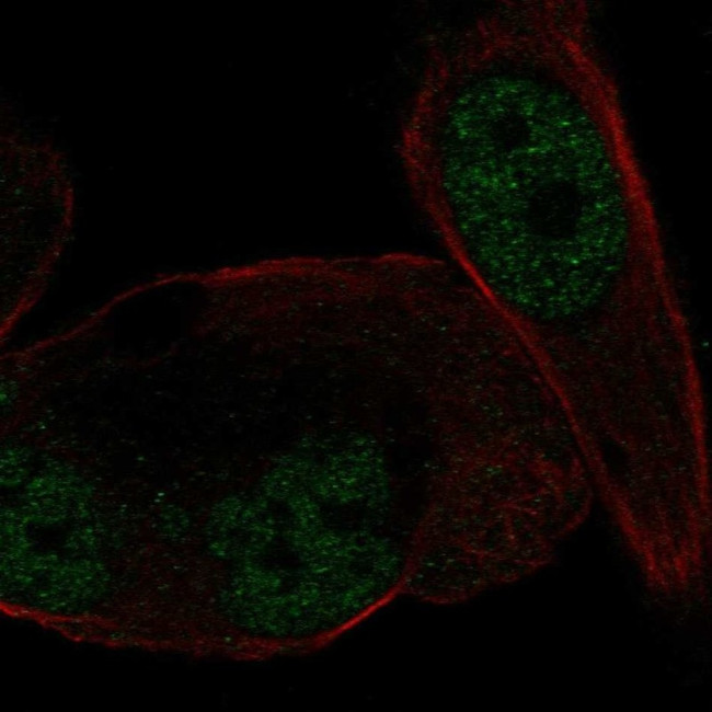 NR3C2 Antibody in Immunocytochemistry (ICC/IF)