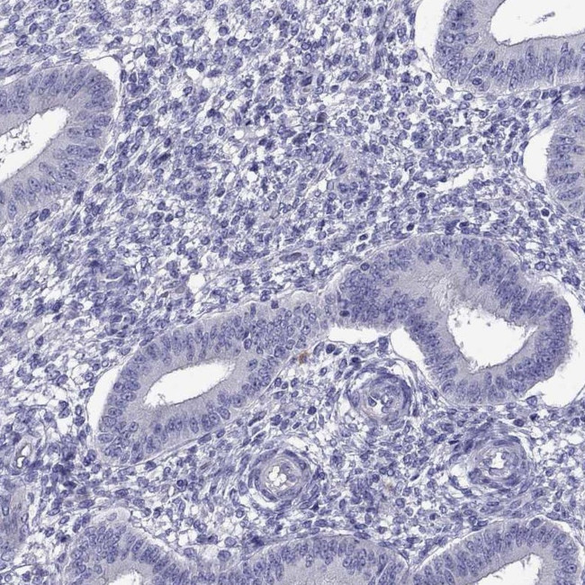 OXCT2 Antibody in Immunohistochemistry (Paraffin) (IHC (P))