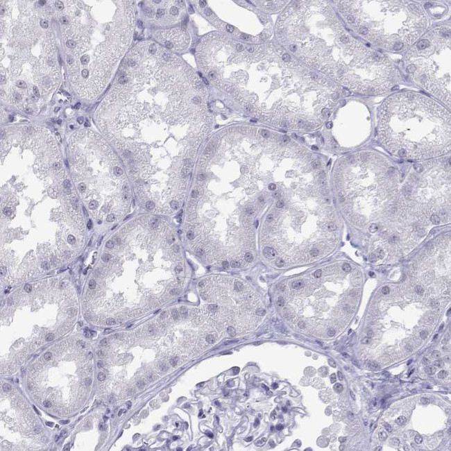 LOR Antibody in Immunohistochemistry (Paraffin) (IHC (P))