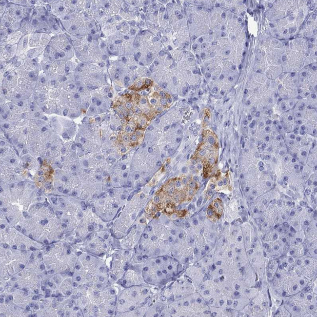 SLC30A8 Antibody in Immunohistochemistry (Paraffin) (IHC (P))