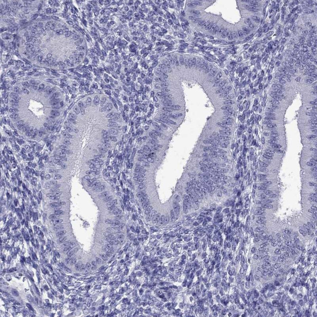 DNAH17 Antibody in Immunohistochemistry (Paraffin) (IHC (P))