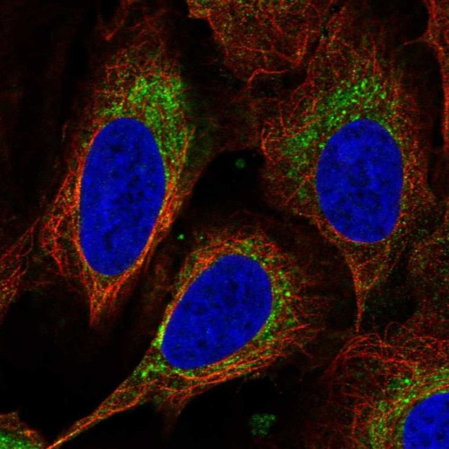 DEGS1 Antibody in Immunocytochemistry (ICC/IF)