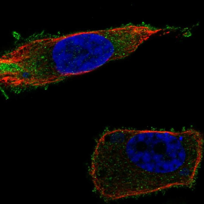 SLC27A1 Antibody in Immunocytochemistry (ICC/IF)