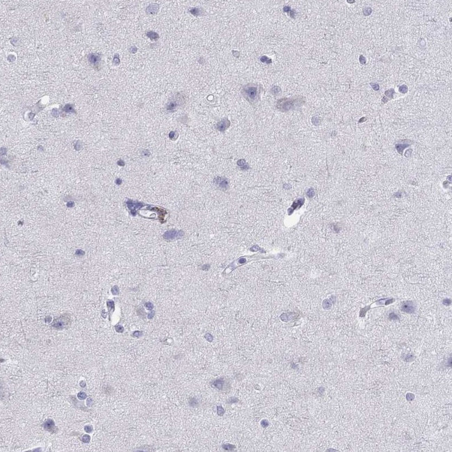 CAPNS2 Antibody in Immunohistochemistry (Paraffin) (IHC (P))