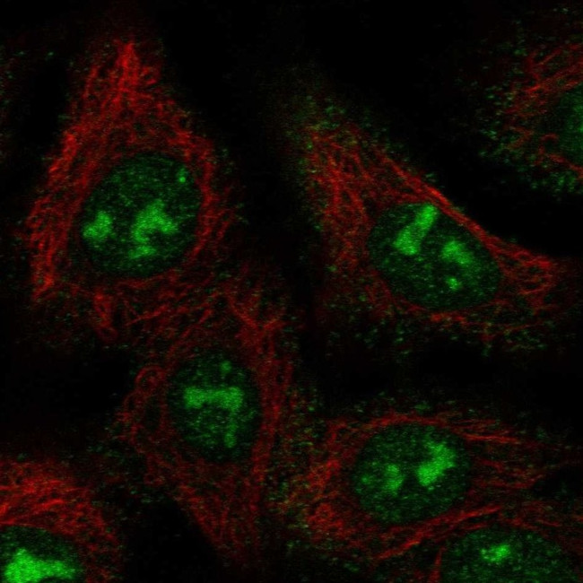 BAHCC1 Antibody in Immunocytochemistry (ICC/IF)