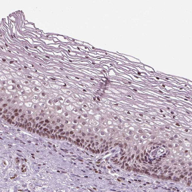 HEYL Antibody in Immunohistochemistry (Paraffin) (IHC (P))