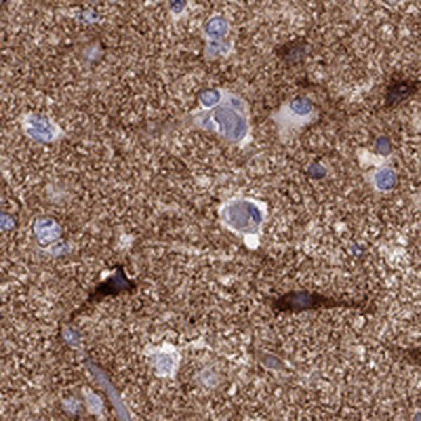 NPTX1 Antibody in Immunohistochemistry (Paraffin) (IHC (P))