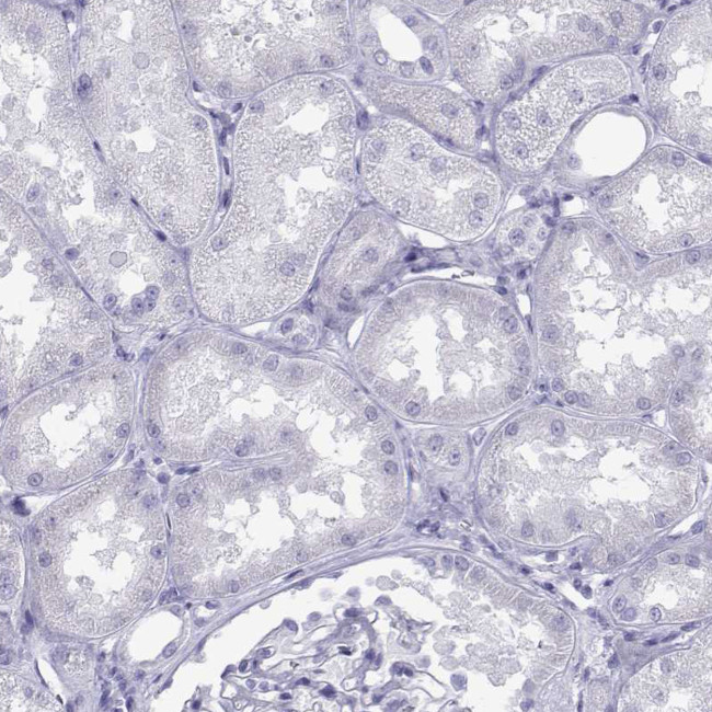 LOR Antibody in Immunohistochemistry (Paraffin) (IHC (P))