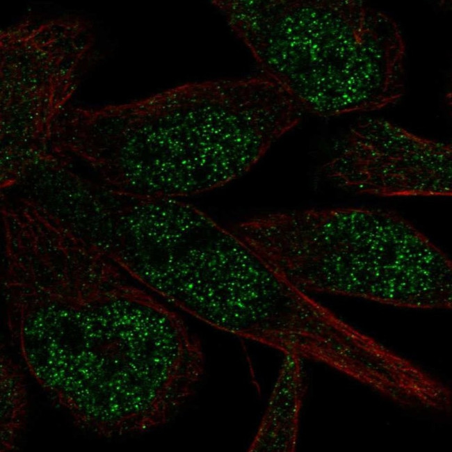 ZNF273 Antibody in Immunocytochemistry (ICC/IF)