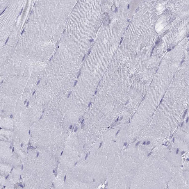 C11orf63 Antibody in Immunohistochemistry (Paraffin) (IHC (P))