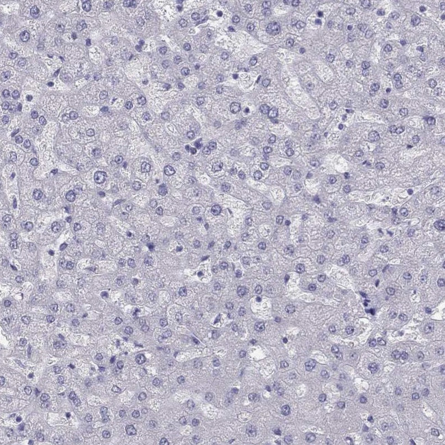 PHOX2A Antibody in Immunohistochemistry (Paraffin) (IHC (P))