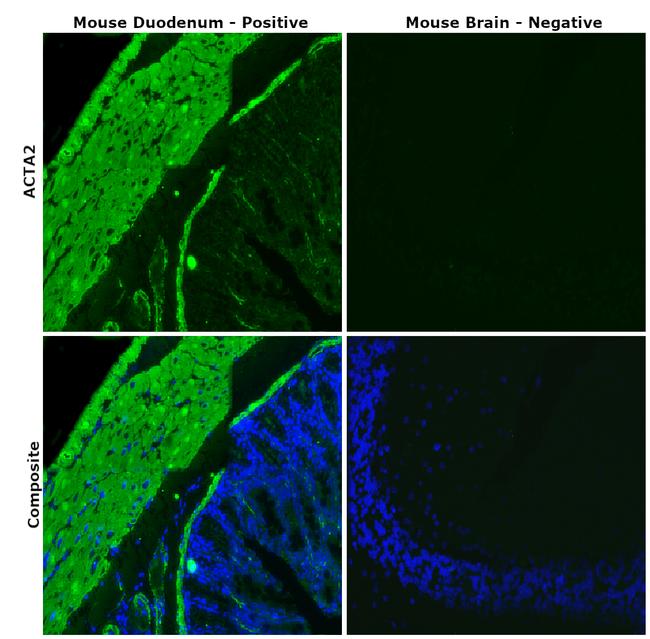 Alpha-Smooth Muscle Actin Antibody in Immunohistochemistry (Paraffin) (IHC (P))