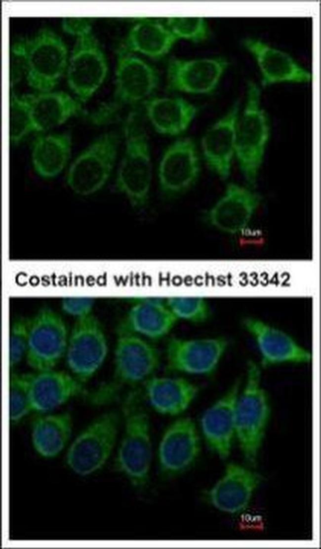 alpha-1a Adrenergic Receptor Antibody in Immunocytochemistry (ICC/IF)