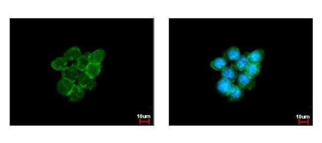 Caveolin 1 Antibody in Immunocytochemistry (ICC/IF)