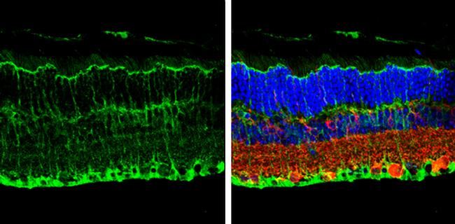 Cannabinoid Receptor 1 Antibody in Immunohistochemistry (Paraffin) (IHC (P))