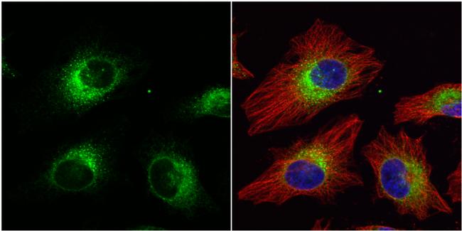 ERp57 Antibody in Immunocytochemistry (ICC/IF)