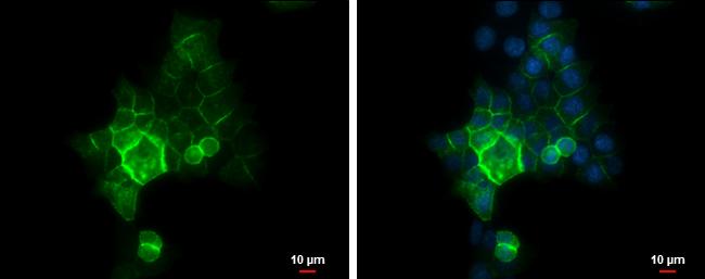 E-cadherin Antibody in Immunocytochemistry (ICC/IF)