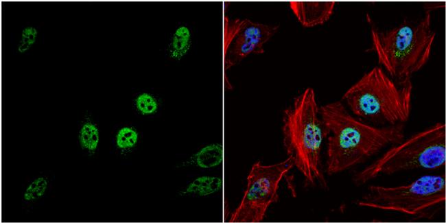 HDAC1 Antibody in Immunocytochemistry (ICC/IF)