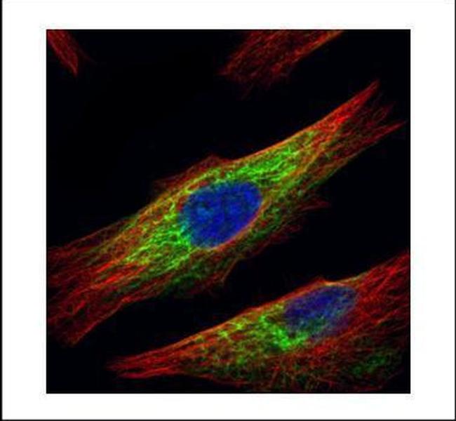 HDAC6 Antibody in Immunocytochemistry (ICC/IF)