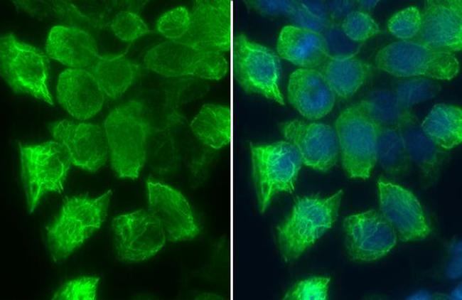 Phospho-RAC1/CDC42 (Ser71) Antibody in Immunocytochemistry (ICC/IF)