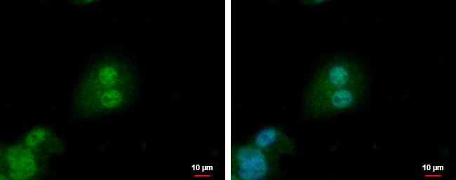 PTHLH Antibody in Immunocytochemistry (ICC/IF)