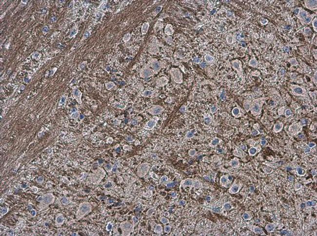 Collagen II Antibody in Immunohistochemistry (Paraffin) (IHC (P))