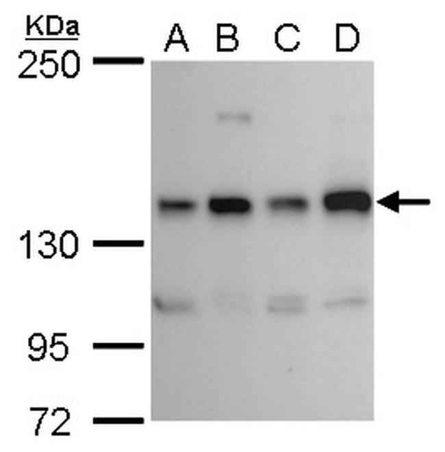 RET Antibody in Western Blot (WB)