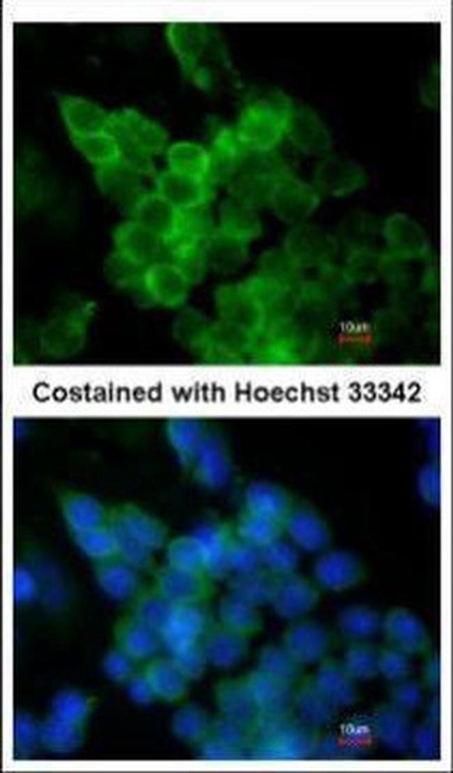 LPL Antibody in Immunocytochemistry (ICC/IF)