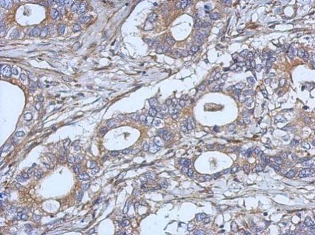 IL-2 Antibody in Immunohistochemistry (Paraffin) (IHC (P))