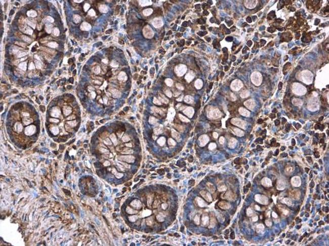 Decorin Antibody in Immunohistochemistry (Paraffin) (IHC (P))