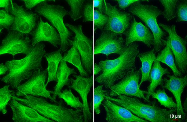 beta Tubulin Antibody in Immunocytochemistry (ICC/IF)