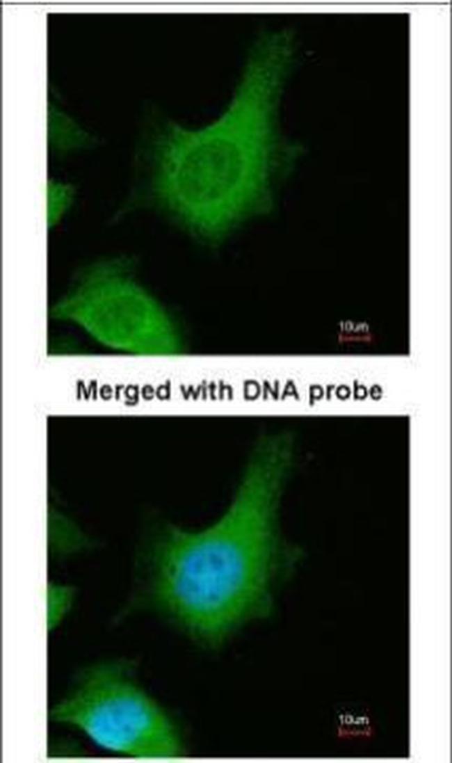 Calcium Sensing Receptor Antibody in Immunocytochemistry (ICC/IF)