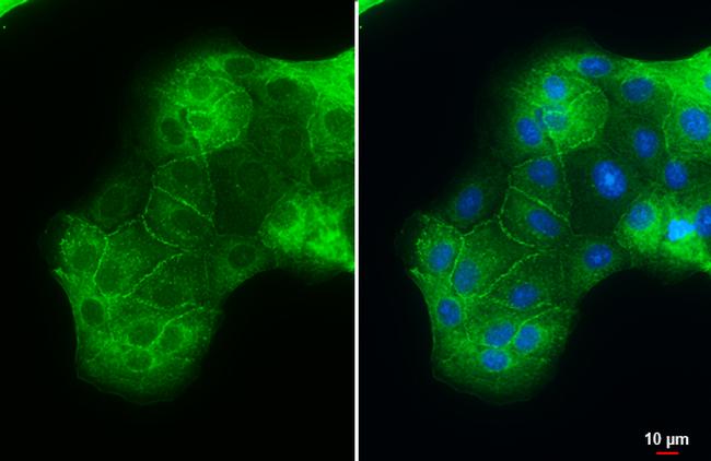 ACE2 Antibody in Immunocytochemistry (ICC/IF)