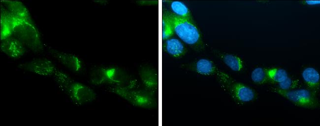 APOE Antibody in Immunocytochemistry (ICC/IF)