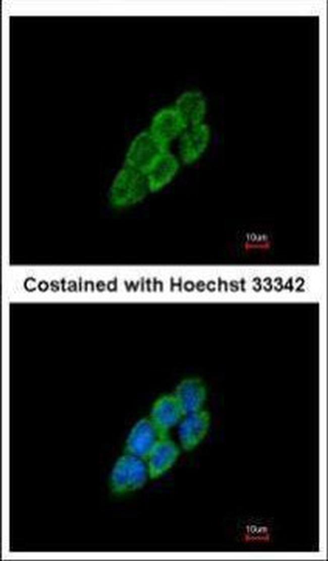 LTBP4 Antibody in Immunocytochemistry (ICC/IF)