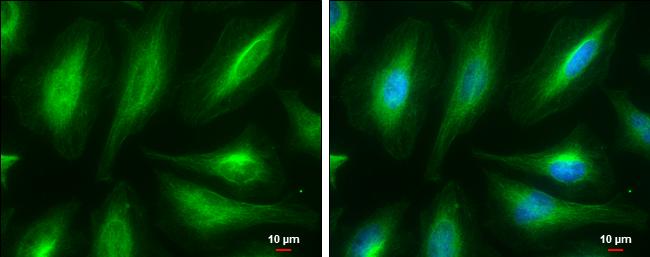 alpha Tubulin Antibody in Immunocytochemistry (ICC/IF)