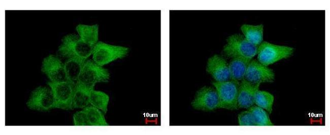 alpha Tubulin Antibody in Immunocytochemistry (ICC/IF)