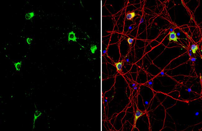 GRP78 Antibody in Immunocytochemistry (ICC/IF)