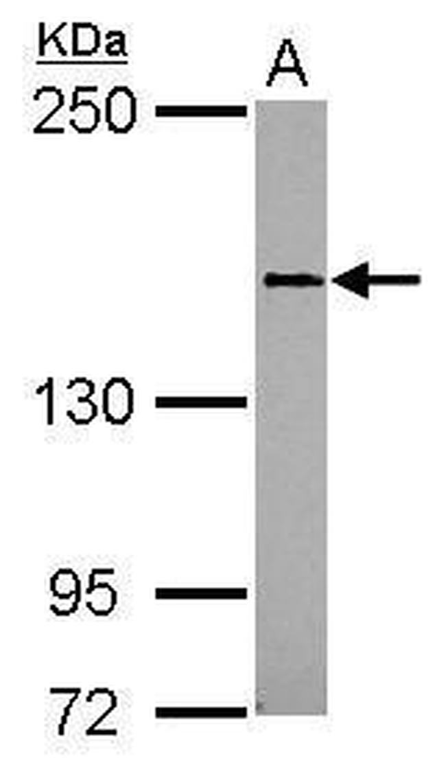 CD100 Antibody in Western Blot (WB)