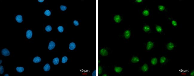 c-Myc Antibody in Immunocytochemistry (ICC/IF)