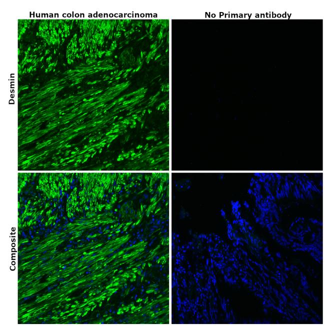 Desmin Antibody in Immunohistochemistry (Paraffin) (IHC (P))