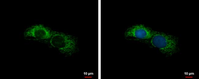 ALDH7A1 Antibody in Immunocytochemistry (ICC/IF)