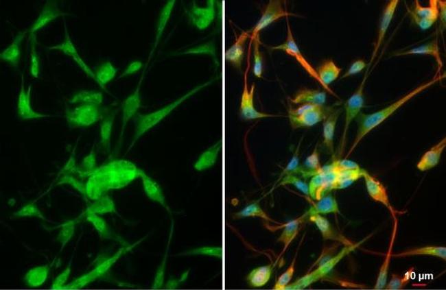 MMP2 Antibody in Immunocytochemistry (ICC/IF)