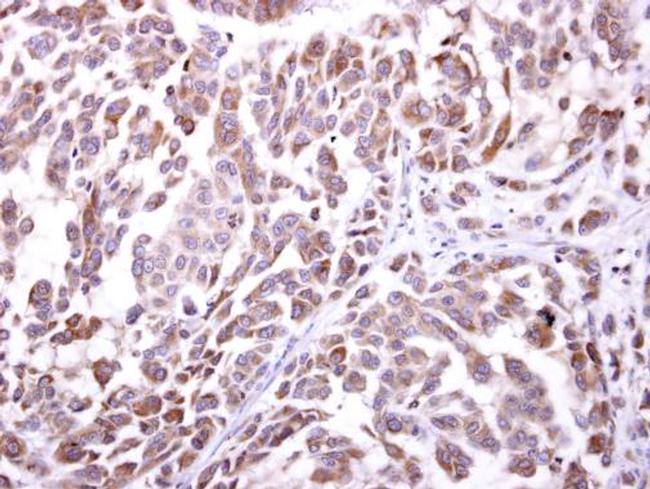 NKG2D Antibody in Immunohistochemistry (Paraffin) (IHC (P))