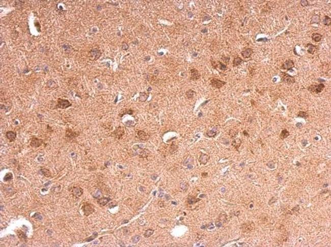 Adiponectin Receptor 1 Antibody in Immunohistochemistry (Paraffin) (IHC (P))