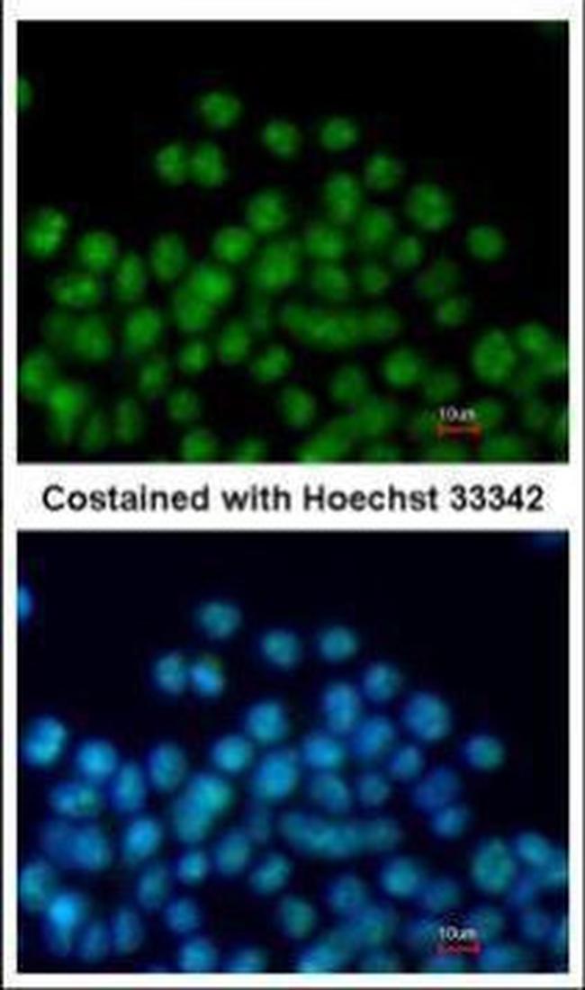 Nkx2.5 Antibody in Immunocytochemistry (ICC/IF)